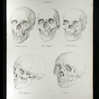 Oesterreicher, Johann Heinrich (1805-1843): - Racenverschiedenheit.