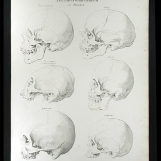 Oesterreicher, Johann Heinrich (1805-1843): - Racenverschiedenheit.