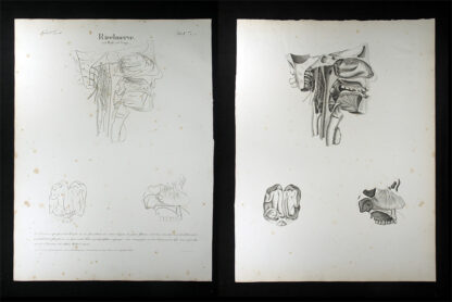 Oesterreicher, Johann Heinrich (1805-1843): - Riechnerve.