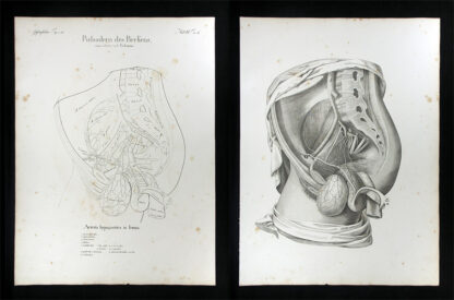 Oesterreicher, Johann Heinrich (1805-1843): - Pulsadern des Beckens - Arteria hypogastrica in femina.