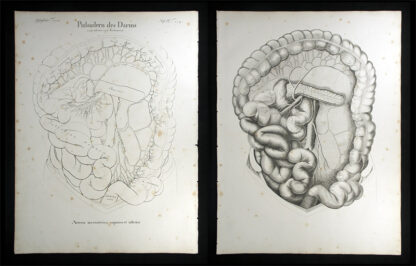 Oesterreicher, Johann Heinrich (1805-1843): - Pulsadern des Darms - Arteria mesenterica superior et inferior.