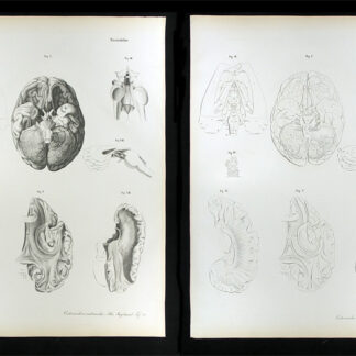 Erdl, M(ichael) P(ius) (1815-1848): - Nervenlehre.