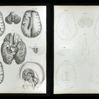 Erdl, M(ichael) P(ius) (1815-1848): - Nervenlehre.