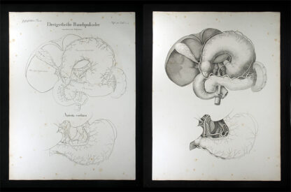 Oesterreicher, Johann Heinrich (1805-1843): - Dreigetheilte Bauchpulsader.