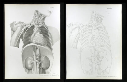 Erdl, M(ichael) P(ius) (1815-1848): - Gefässlehre.